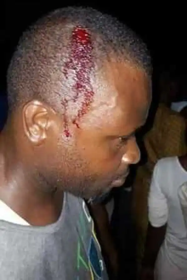 Photo: man head busted during rerun election in Rivers State